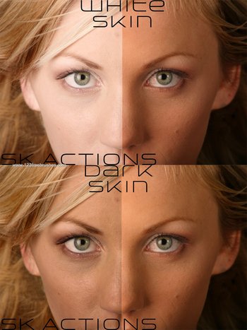 Skin Actions