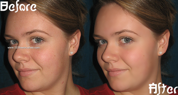 Skin Smoothing Action