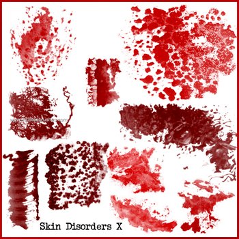 Blood Skin Disorders