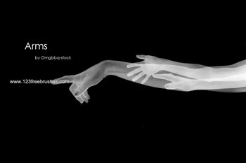 Arm