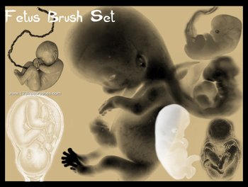 Fetus
