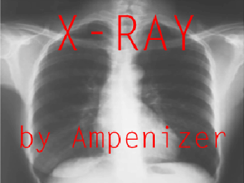 X-Ray