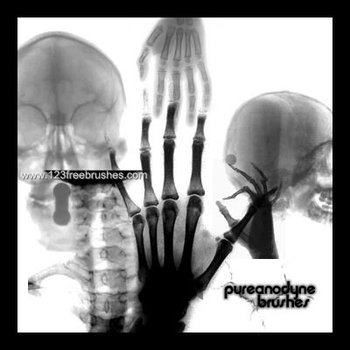X-Ray
