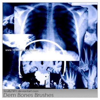 Bones